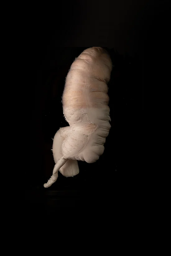 stomach